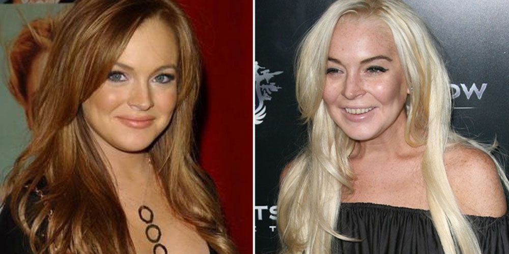 15 Haunting Photos Of Celebs Who Destroyed Their Body