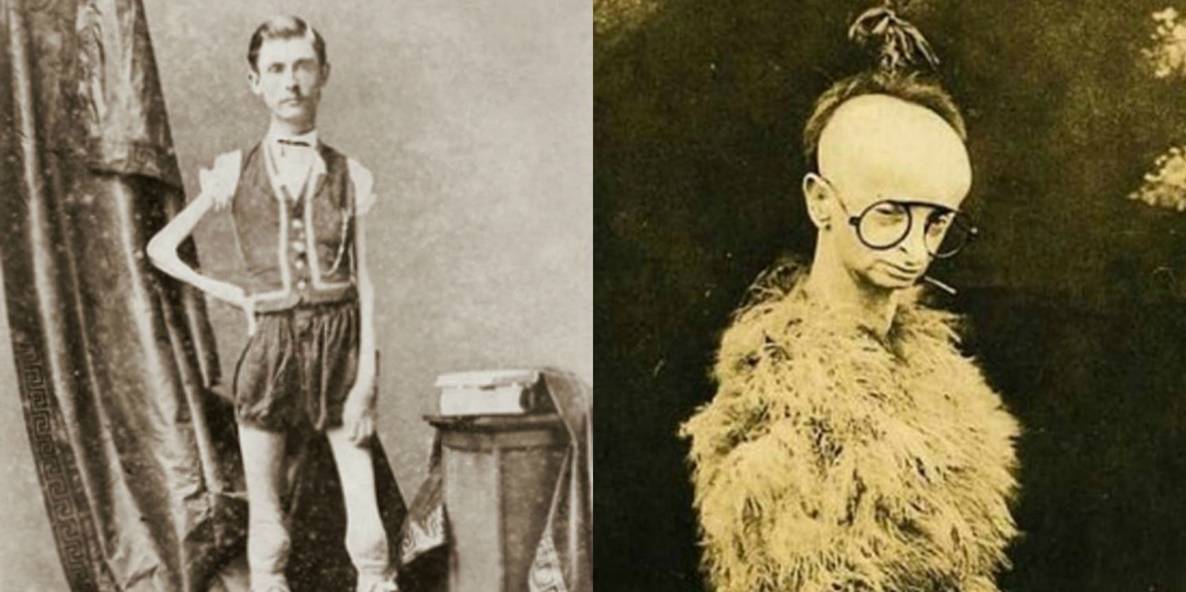 Chilling Vintage Photos Of Freak Shows That Will Give Us Nightmares