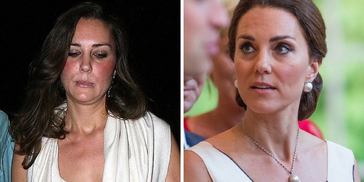 Photos That Prove That Kate Middleton Isn T Attractive