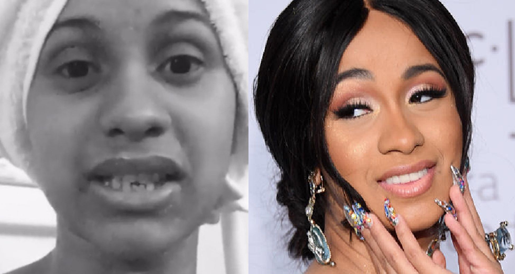 Cardi B Teeth Before And After - TeethWalls